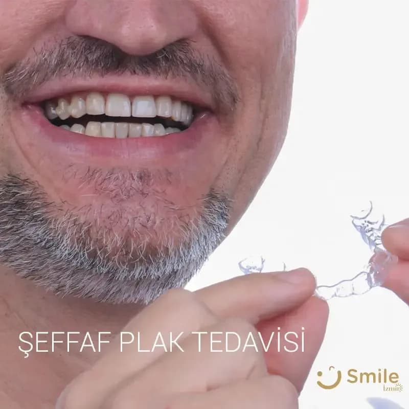 Kieferorthopädie mit
unsichtbaren Alignern