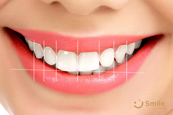 Dijital Gülüş Tasarımı - Smile İzmir tedavi görseli