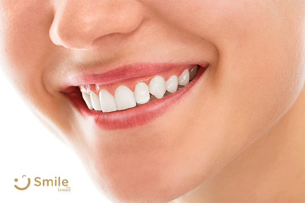 Diş Eti Tedavileri - Smile İzmir tedavi görseli
