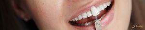 Was ist Zirkonium Dental Veneer? Vorteile und Nachteile