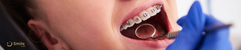 Ortodontik-tedavi-nedir