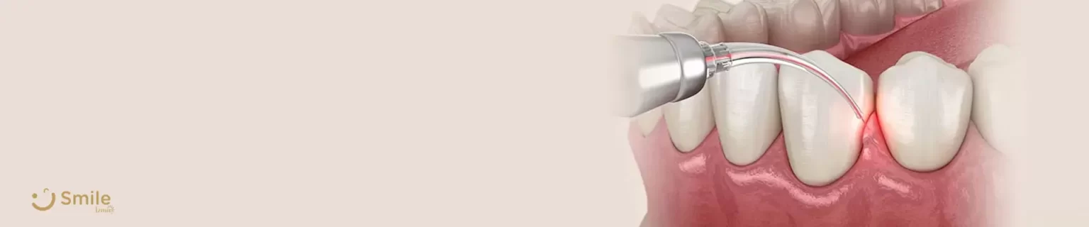 diş-eti-büyümesi-nedir