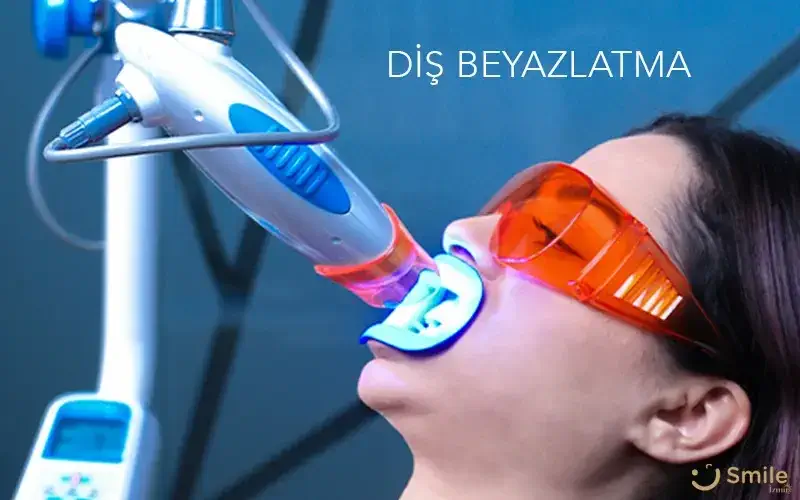 izmir dis beyazlatma